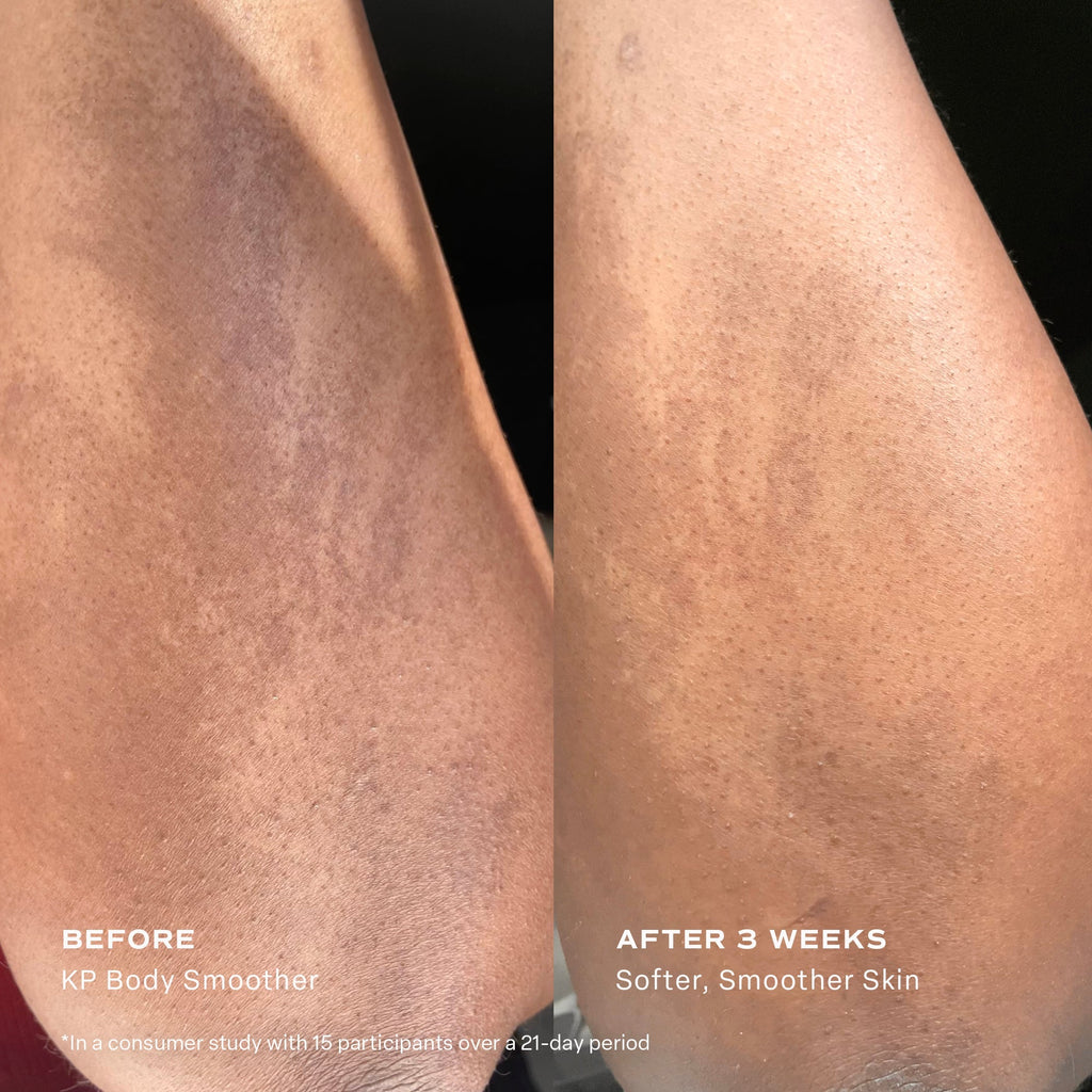 KP Body Smoother Exfoliating Milk